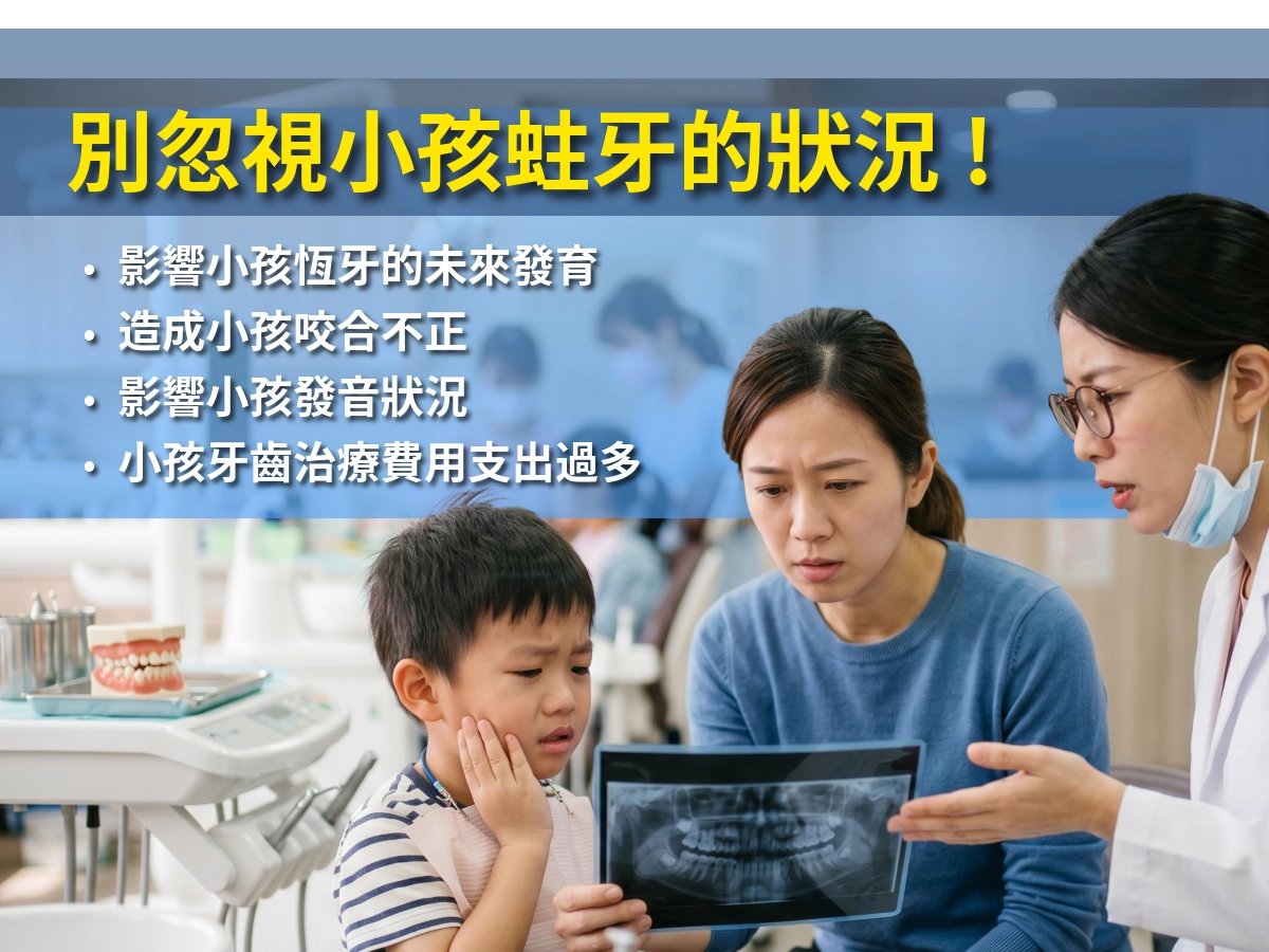 不要輕忽小孩蛀牙