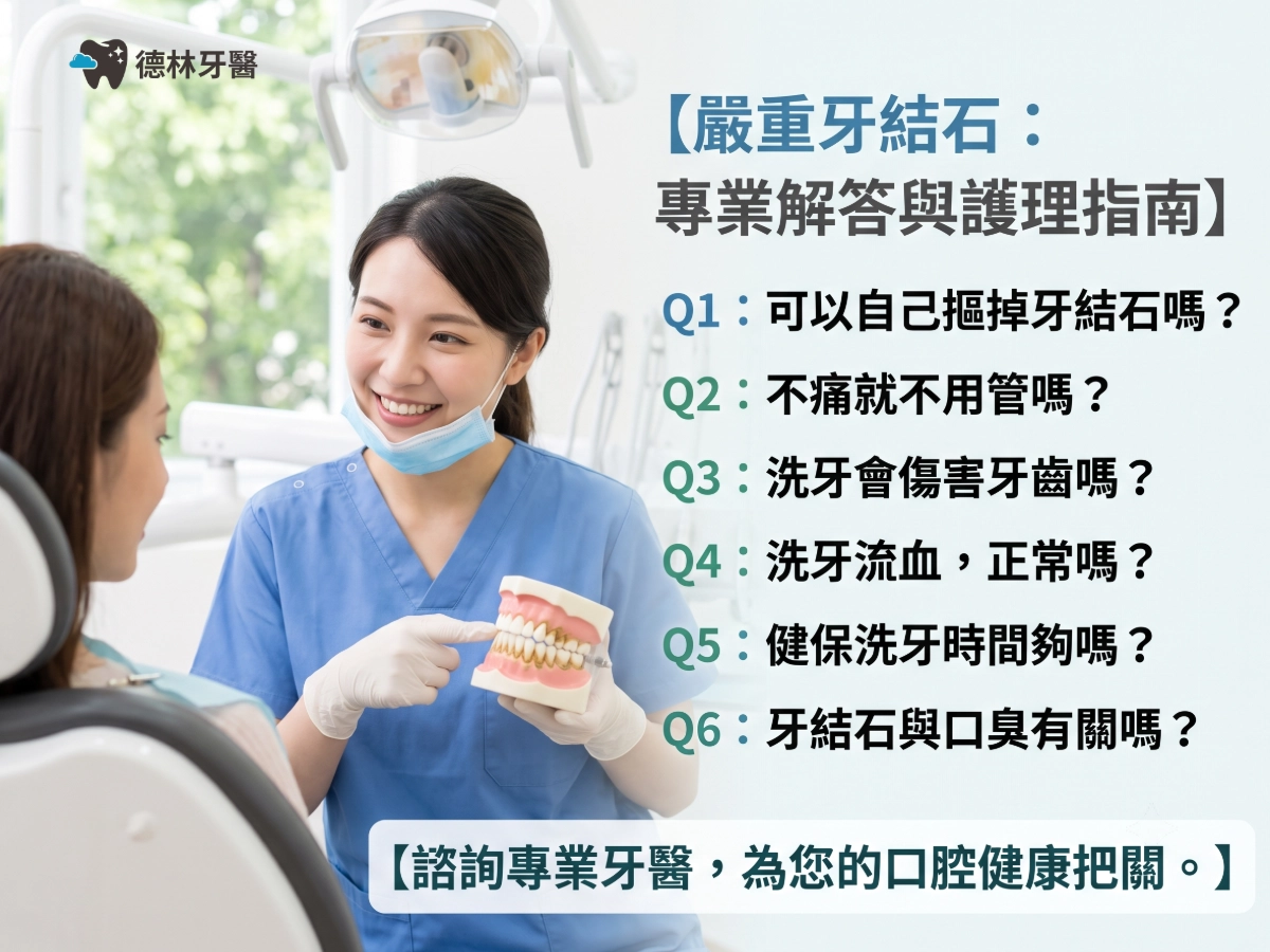 嚴重牙結石｜常見問題