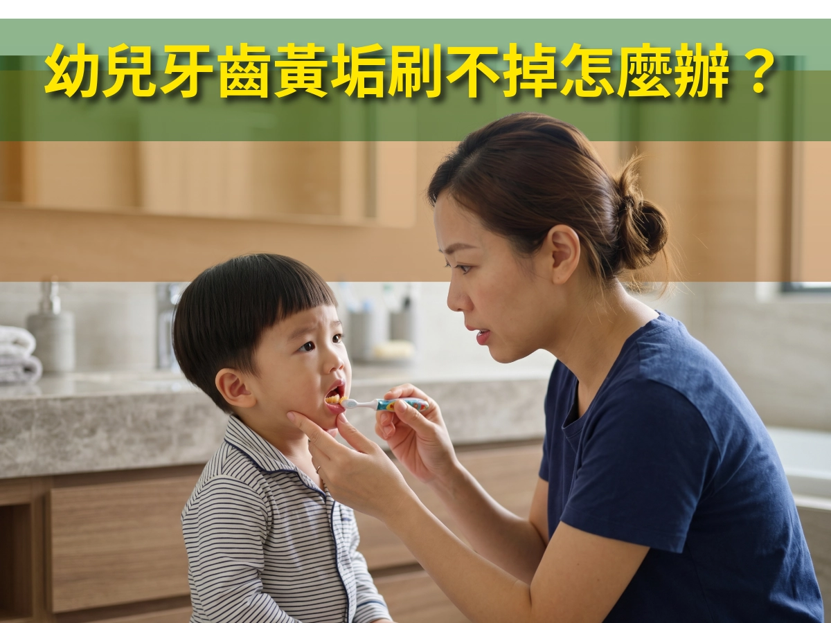 幼兒牙齒黃垢刷不掉怎麼辦