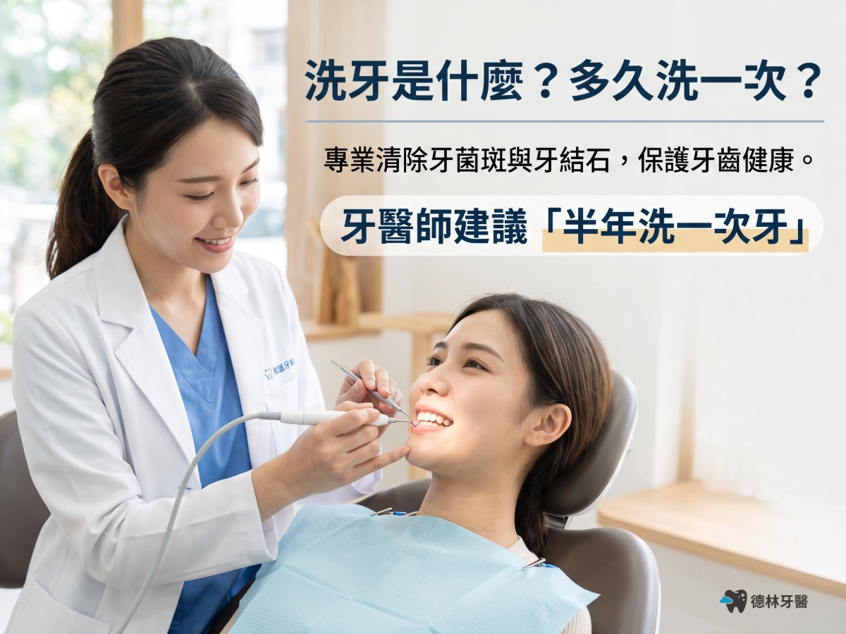 洗牙是什麼?多久洗一次