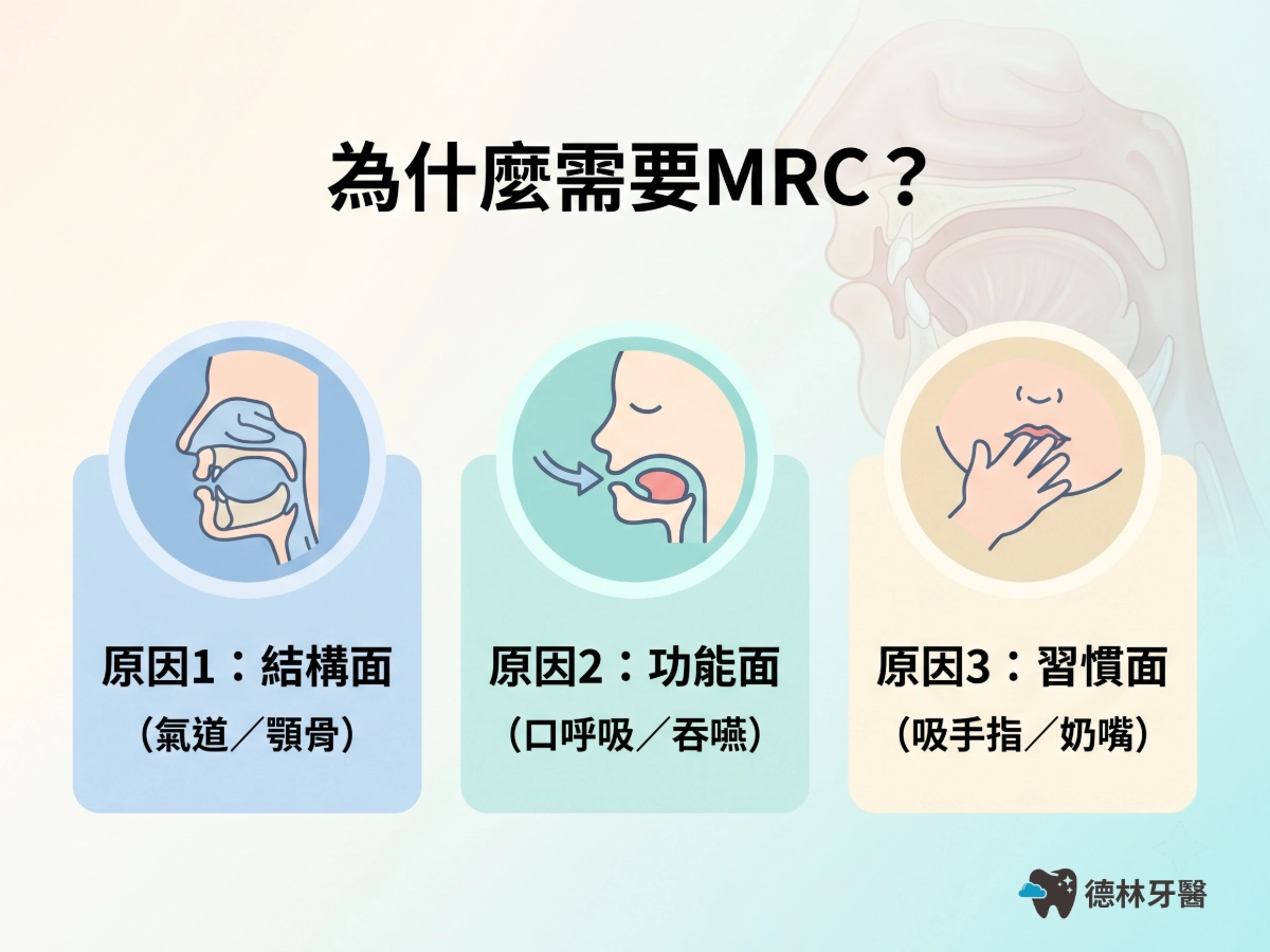 為什麼需要MRC？咬合不正3大成因