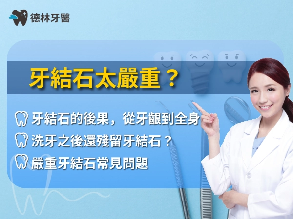 牙結石太嚴重？只有洗牙沒有用！嚴重牙結石不只口臭，還會掉牙！