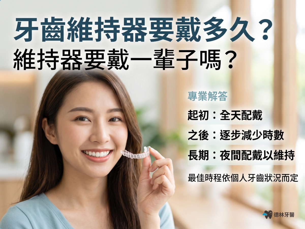 牙齒維持器要戴多久