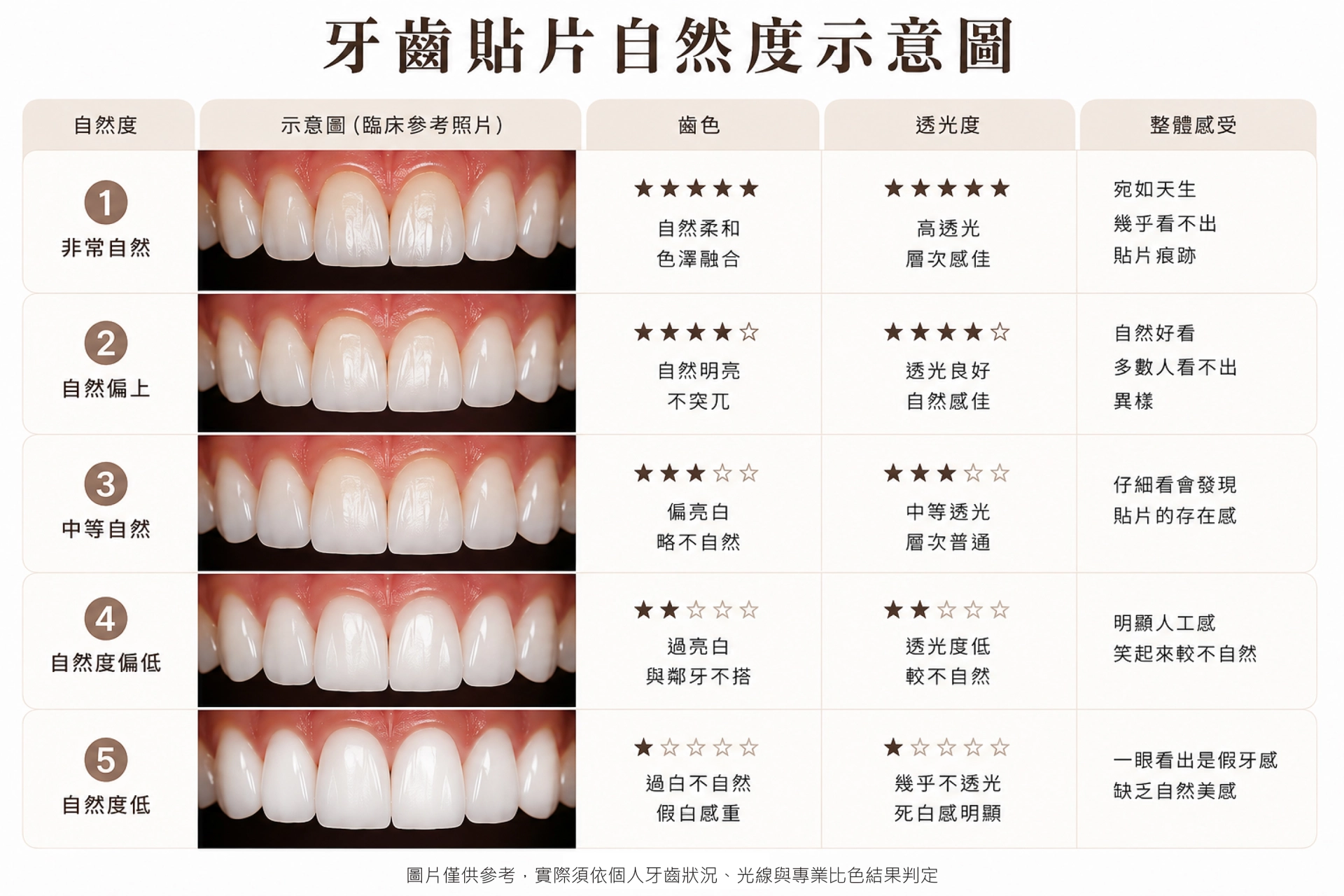 牙齒貼片自然度示意圖/德林牙醫