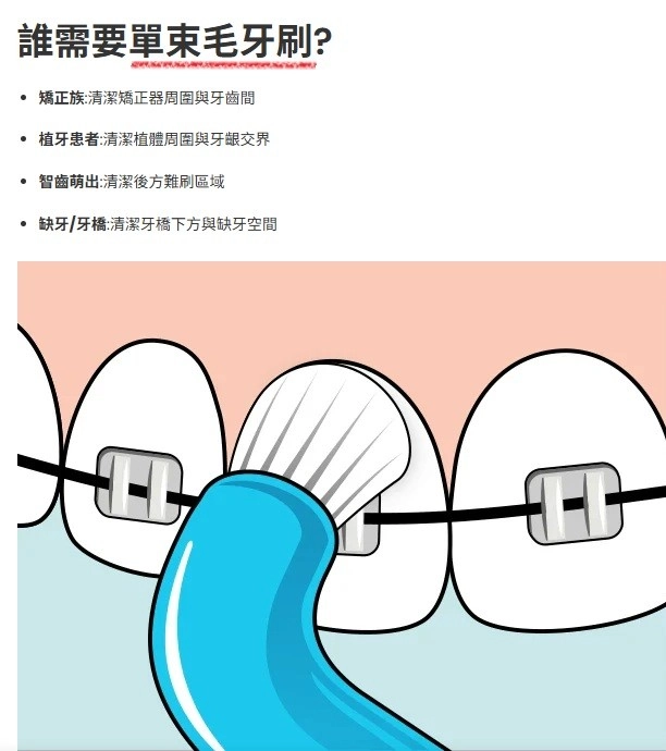 誰需要單束毛牙刷